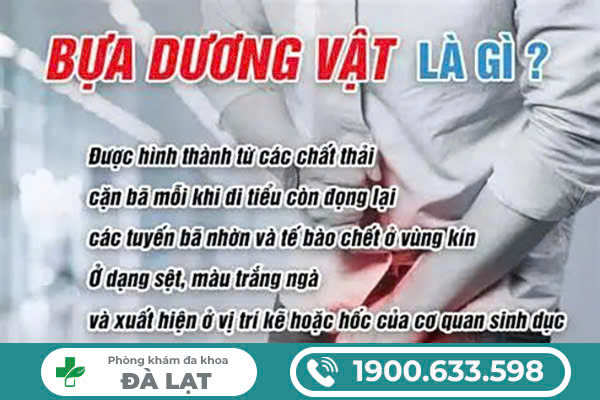 Hình ảnh minh họa